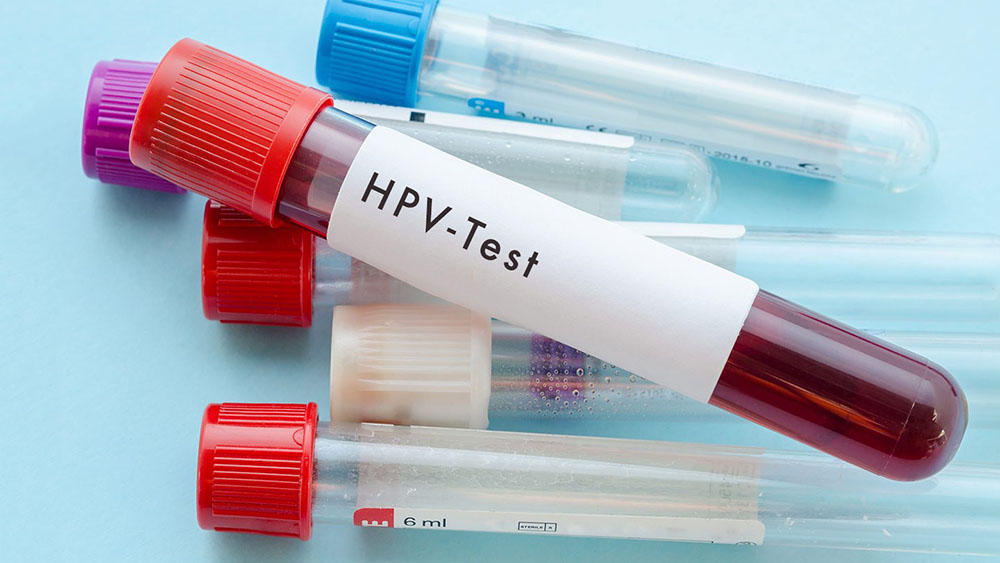HPV testi nedir?
