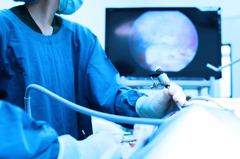Laparoskopik Ameliyatların Hasta İçin Avantajları